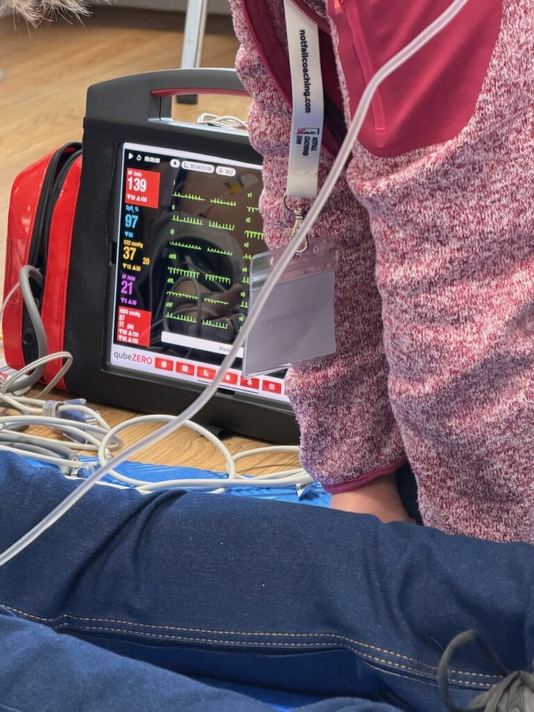 EKG Display mit Herzrhythmusstörungen